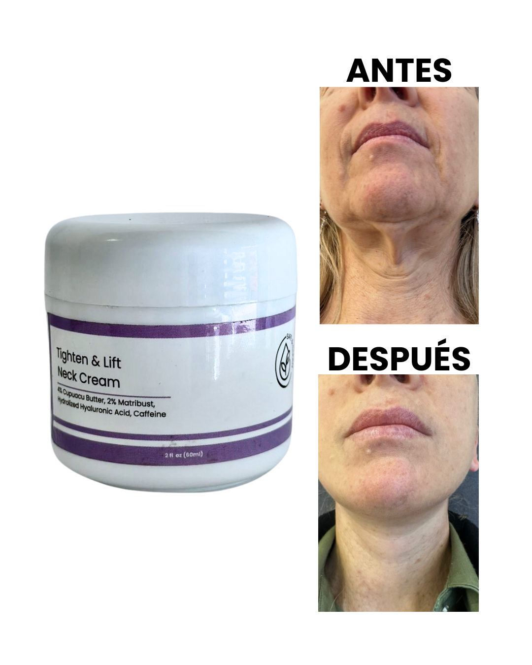 REAFIRMANTE PARA CUELLO TIGHTEN & LIFT